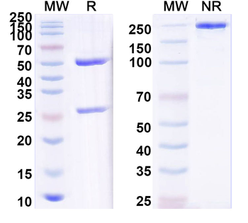 Vibrio cholerae ctxB/Cholera Toxin Subunit B Human Monoclonal Antibody