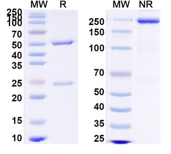 Vibrio cholerae ctxB/Cholera Toxin Subunit B Human Monoclonal Antibody