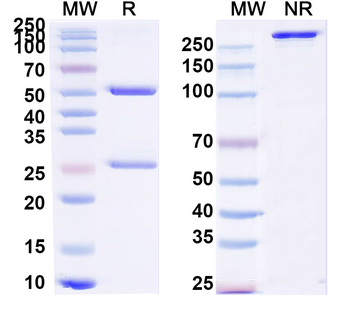 Clostridium tetani tetX/Tetanus toxin Mouse Monoclonal Antibody