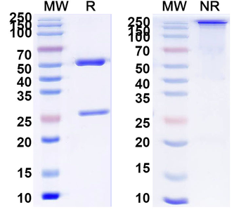 DRD2 Mouse Monoclonal Antibody