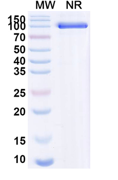 Mal f 1/Allergen Pit o 1 Human Monoclonal Antibody