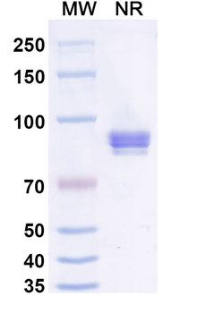 Mal f 1/Allergen Pit o 1 Human Monoclonal Antibody