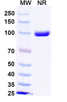 Mal f 1/Allergen Pit o 1 Human Monoclonal Antibody