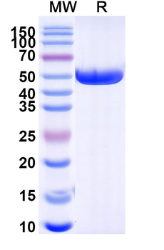 Mal f 1/Allergen Pit o 1 Human Monoclonal Antibody