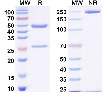 oxLDL Mouse Monoclonal Antibody