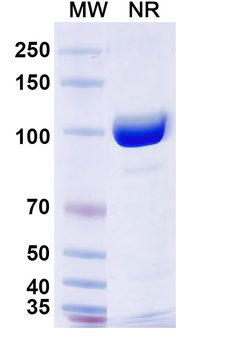 TG/Thyroglobulin Human Monoclonal Antibody
