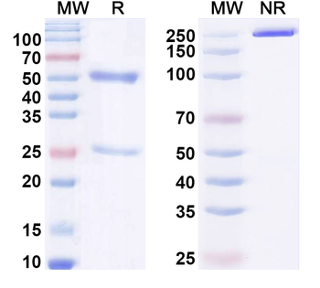 TAPBP/Tapasin Mouse Recombinant Antibody