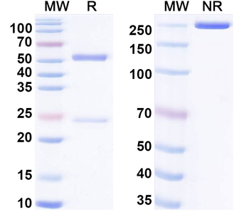 CBV1 mature virion in complex Human Monoclonal Antibody