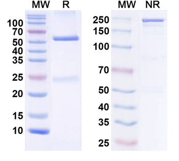 FAP Human Monoclonal Antibody