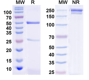 TSLP Human Monoclonal Antibody