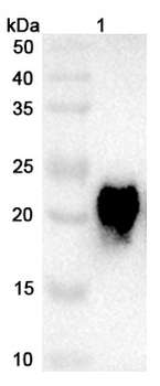 TSLP Human Monoclonal Antibody