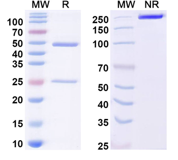 Dermatophagoides pteronyssinus DERP2/DERPII Human Monoclonal Antibody