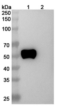 RAGE Human Monoclonal Antibody
