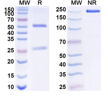 B2M/Beta-2-microglobulin Mouse Monoclonal Antibody
