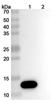 B2M/Beta-2-microglobulin Mouse Monoclonal Antibody