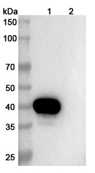 CTSL Mouse Monoclonal Antibody