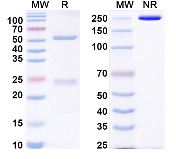 GRIN1/NMDAR1 Mouse Monoclonal Antibody
