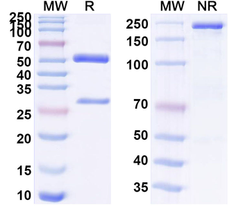 LGALS3/Galectin-3 Mouse Monoclonal Antibody