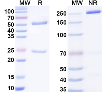 Phospho-Vimentin Mouse Monoclonal Antibody