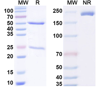 Phospho-Tau Mouse Monoclonal Antibody
