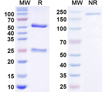 Vibrio cholerae ctxB/Cholera Toxin Subunit B Human Monoclonal Antibody