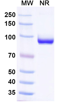 VSV NP/Nucleoprotein Human Monoclonal Antibody