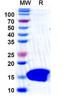 Clostridium botulinum botA/BOTOX Camelus Monoclonal Antibody
