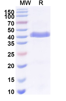 SFTPA Mouse Monoclonal Antibody