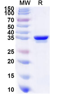 Recombinant Human CDK11B Protein, N-His
