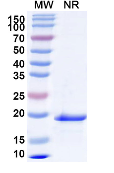 Recombinant Mouse IL24 Protein, N-His