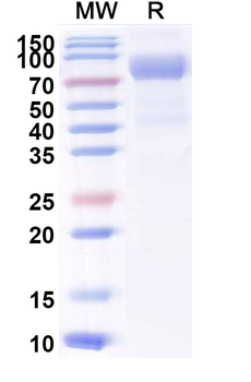 Recombinant Mouse CD122/IL2RB Protein, C-Fc