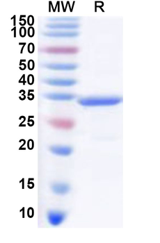 Recombinant PDCoV Nsp5/Mpro/3CL Protein, N-His
