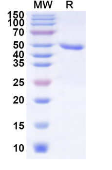JEV NS1/Non-structural protein 1 Recombinant Protein (N-His)