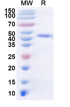 Recombinant Influenza A virus (H7N9) NA/Neuraminidase Protein, N-His