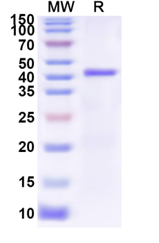 Recombinant Influenza A virus (H7N4) NA/Neuraminidase Protein, N-His