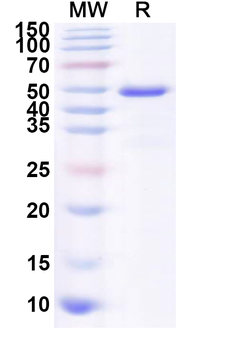 Recombinant Influenza A virus (H7N3) NA/Neuraminidase Protein, N-His