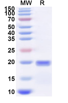 Recombinant Influenza A virus (H5N6) NA/Neuraminidase Protein, N-His