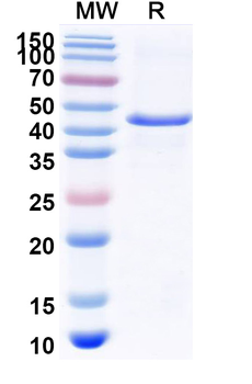 Recombinant Influenza A virus (H3N8) NA/Neuraminidase Protein, N-His