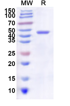 Recombinant Influenza A virus (H3N2) NA/Neuraminidase Protein, N-His