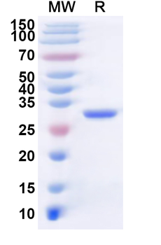 Recombinant Influenza A virus (H2N2) HA/Hemagglutinin Protein, N-His