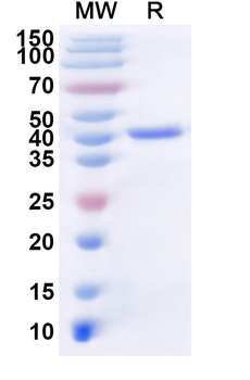 Recombinant Influenza A virus (H1N1) NA/Neuraminidase Protein, N-His