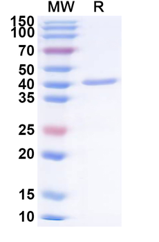 Recombinant Influenza A virus (H18N11) NA/Neuraminidase Protein, N-His