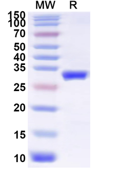 Recombinant Influenza A virus (H18N11) HA/Hemagglutinin Protein, N-His