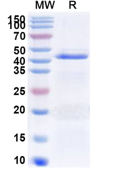 Recombinant Influenza A virus (H17N10) NA/Neuraminidase Protein, N-His