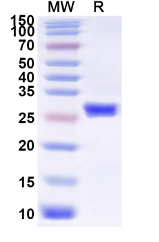 Recombinant Influenza A virus (H17N10) HA/Hemagglutinin Protein, N-His