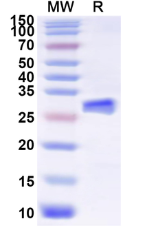 Recombinant Influenza A virus (H13N8) HA/Hemagglutinin Protein, N-His