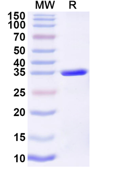 Recombinant Influenza A virus (H12N5) HA/Hemagglutinin Protein, N-His