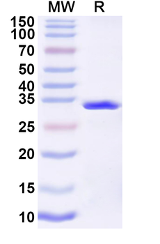 Recombinant Influenza A virus (H10N7) HA/Hemagglutinin Protein, N-His