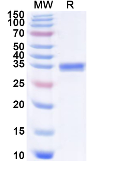 Recombinant EV68 VP2/P1B Protein, N-His