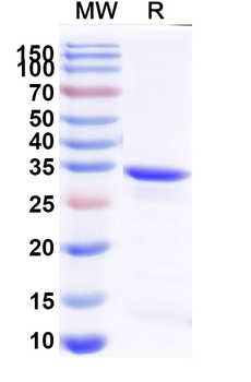 Recombinant Mouse AZGP1 Protein, N-His